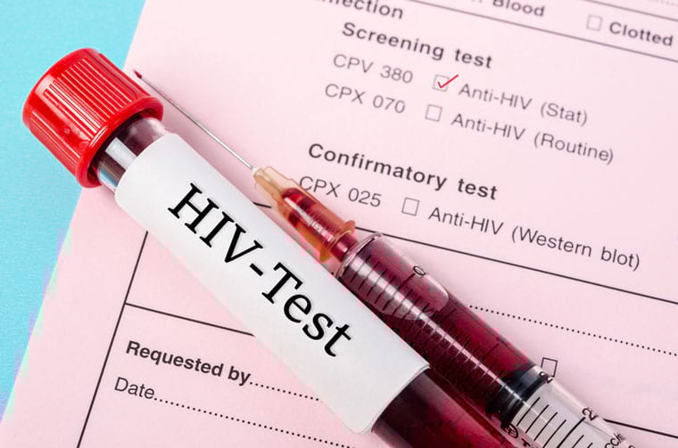בדיקת HIV